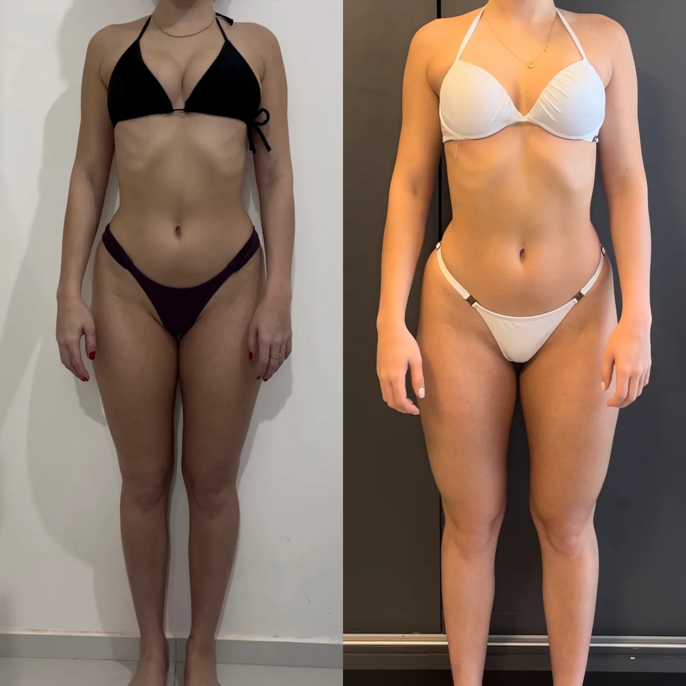Antes e depois de uma aluna da consultoria